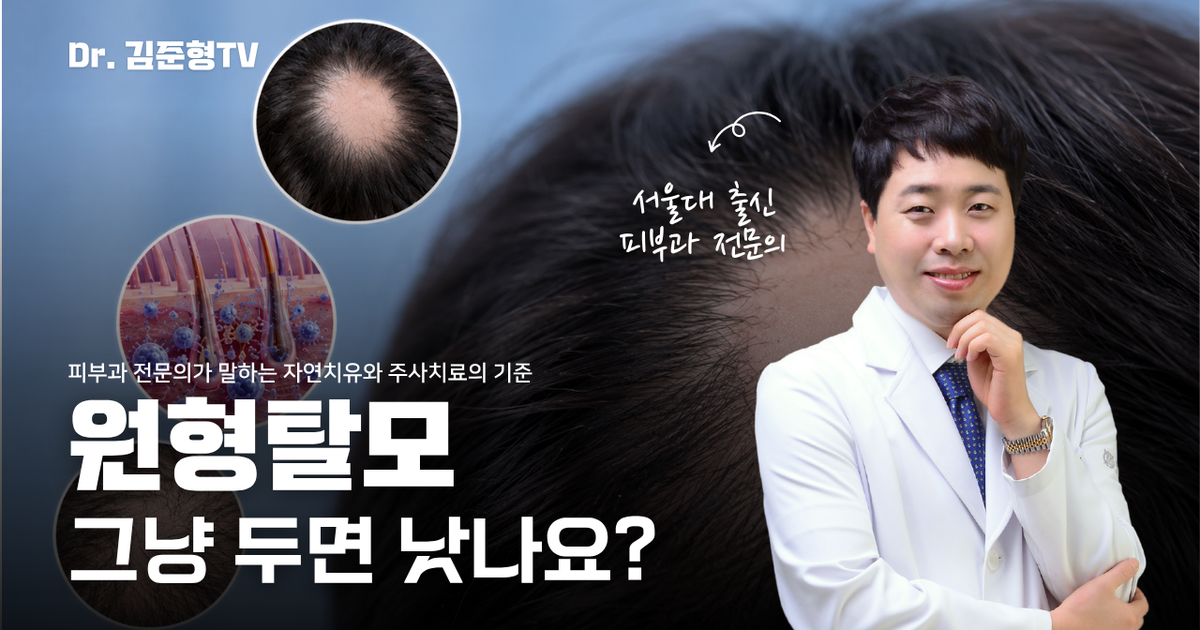 원형탈모, 그냥 두면 자연치유 될까? 피부과 전문의가 알려주는 원인·주사치료·재발 가능성 - 서울에이치피부과